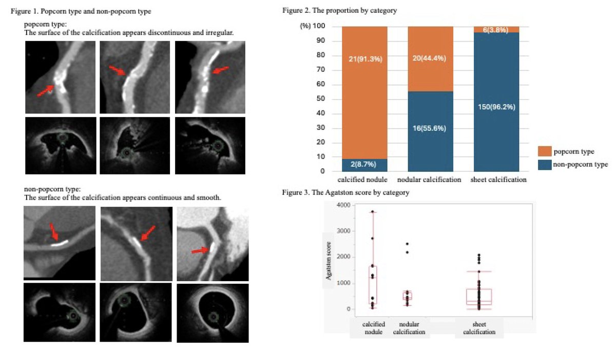 Prof. Hector M. Garcia-Garcia (@hect2701) on Twitter photo #ESCcongress 2025 #abstract
“Popcorn type #calcification by #CCTA was a strong predictor of #CN by #OCT/OFDI.”
<a href="/TCTMD/">TCTMD</a> <a href="/TCTConference/">TCT Conference</a> <a href="/news_hart/">Hector Garcia</a> <a href="/Ortega_Paz/">Luis Ortega Paz</a> <a href="/sjorge4/">Jorge Sanz Sánchez</a> <a href="/sbrugaletta/">Salvatore Brugaletta</a> <a href="/NievesGonzalo1/">Nieves Gonzalo</a> <a href="/CRT_meeting/">CRT Meeting</a> <a href="/GTCardFellows/">Georgetown/WHC Cardiology Fellows</a> <a href="/PCRonline/">PCRonline 🫀</a> #ESCcongress 2025 #abstract
“Popcorn type #calcification by #CCTA was a strong predictor of #CN by #OCT/OFDI.”
<a href="/TCTMD/">TCTMD</a> <a href="/TCTConference/">TCT Conference</a> <a href="/news_hart/">Hector Garcia</a> <a href="/Ortega_Paz/">Luis Ortega Paz</a> <a href="/sjorge4/">Jorge Sanz Sánchez</a> <a href="/sbrugaletta/">Salvatore Brugaletta</a> <a href="/NievesGonzalo1/">Nieves Gonzalo</a> <a href="/CRT_meeting/">CRT Meeting</a> <a href="/GTCardFellows/">Georgetown/WHC Cardiology Fellows</a> <a href="/PCRonline/">PCRonline 🫀</a>