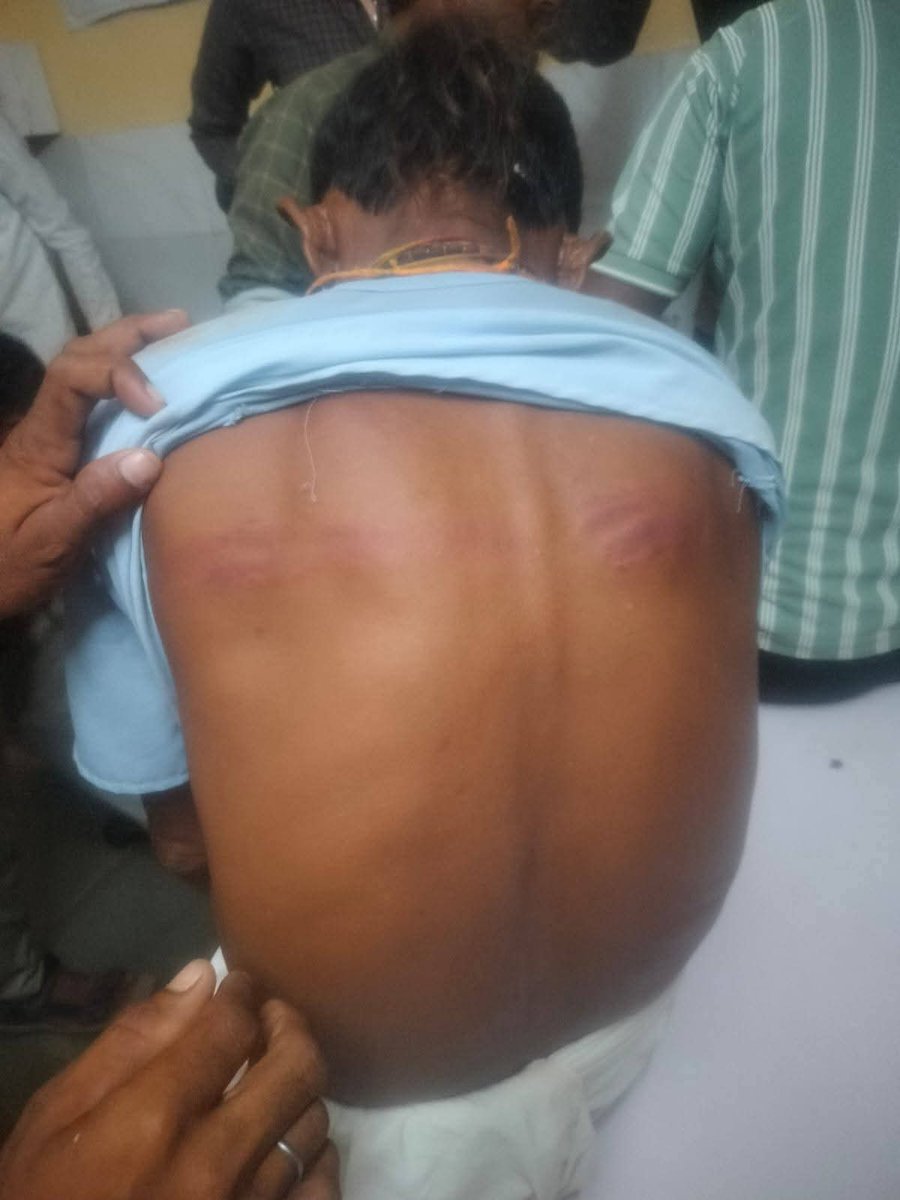 शिव विधानसभा में दुःखद घटना
रावतरा गांव जहां रात को कुछ असामाजिक तत्वों द्वारा कुमावत समाज के घर पर आकर हमला कर कई महिलाओं ओर छोटे मासूम बच्चों को घसीट कर मारा जाता है, दोषियों पर कड़ी कार्यवाही हो।
<a href="/BarmerDm/">Barmer District Collector & Magistrate</a> <a href="/Barmer_Police/">Barmer Police</a> <a href="/RavindraBhati__/">Ravindra Singh Bhati</a>  <a href="/dineshbohrabmr/">Dinesh Bohra</a> <a href="/JoraramKumawat/">Joraram Kumawat</a>