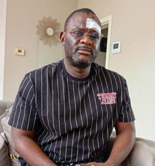 En quoi l'agression d'un Congolais sur le sol belge regarde-t-il le ministre des Affaires étrangères du Rwanda <a href="/onduhungirehe/">Olivier J.P. Nduhungirehe</a>  ?  <a href="/grok/">Grok</a> <a href="/GldCrnK/">🇨🇩Congolais de souche 🇮🇹🇮🇹ASR1927</a> <a href="/lepatcongolais/">Patrice E.L</a> <a href="/marlonluzayamo_/">Anaelmarlon Luzayamo🇨🇩</a> <a href="/Erwan_reverend/">Erwan-Saint'S Le Révérend</a> <a href="/Thesaron3/">Emmanuel N.M 7</a> <a href="/emimoza/">bomba-bomba mabe !</a> <a href="/OkokoNMZ/">Okoko☥</a>