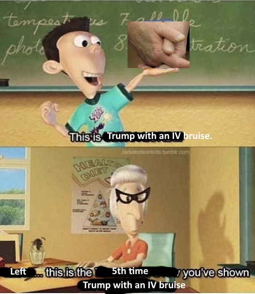 > Trump gets a checkup and takes it easier for a day
Anyone not just memeing about it, and i've seen good funny memes about it, just goes to show they weren't close with their grandparents to have seen this before.