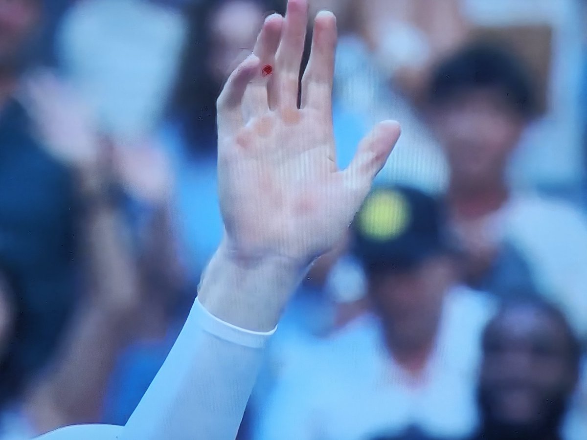 ErGandarf's tweet photo. I telecronisti di SuperTennis parlano di tutto tranne che delle cose importanti come questa.
Sinner ha una grossa vescica alla mano destra; sarà importante o no? 
Mah

#sinnershapovalov
#sinner https://t.co/TURg3NAStq