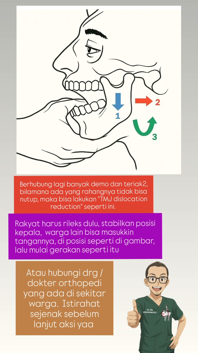Berhubung lagi banyak aksi demonstrasi dan teriak2, bilamana ada yang rahangnya tidak bisa nutup, maka bisa lakukan "TMJ dislocation reduction" seperti ini.