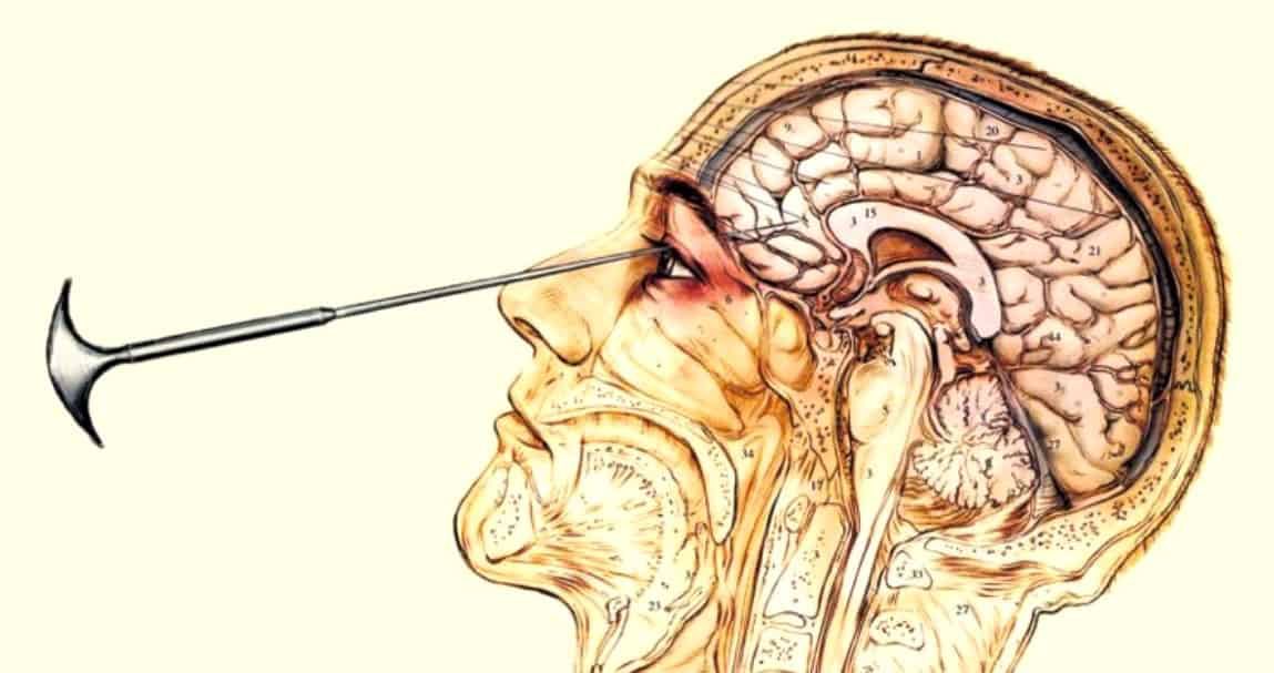 What is going through my head? 

A knife