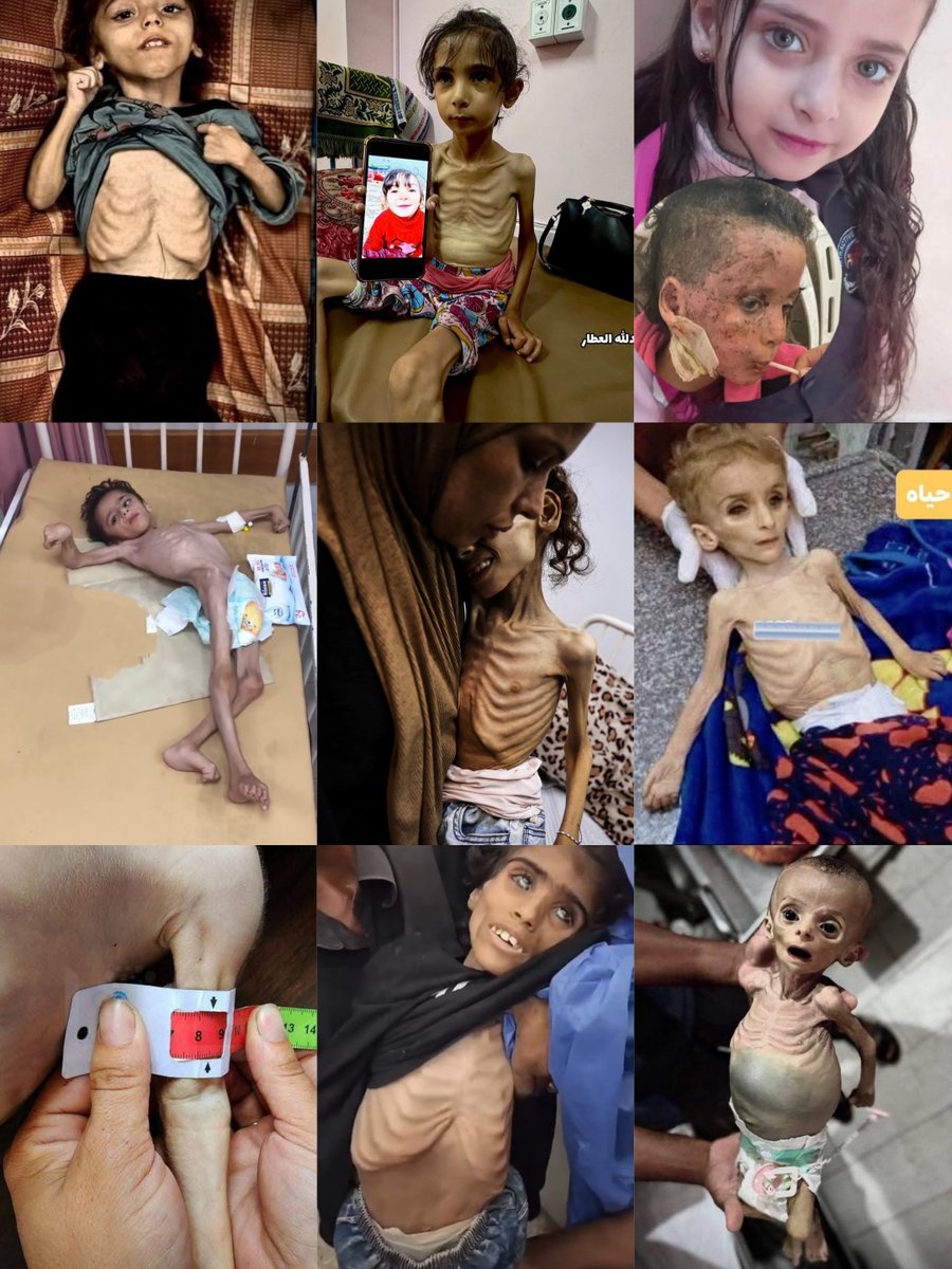 XNews24_7's tweet image. 🚨 URGENT: Famine declared in Gaza by IPC! 😞 Over 500,000 starving, kids dying daily from Israel's blockade. This is a humanitarian catastrophe! Demand ceasefire NOW! #GazaFamine #SaveGaza #Israel