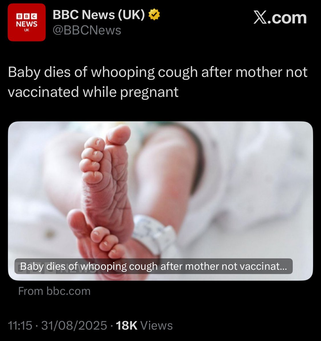 Anti-vaxxers claim yet another baby

#VaccinesStopYouFromSeeingThis
#AntiVaxBabyKillers