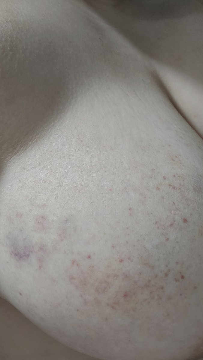 嘿嘿，有素材发咯~
就抽了一会儿胸这样了我天🤤