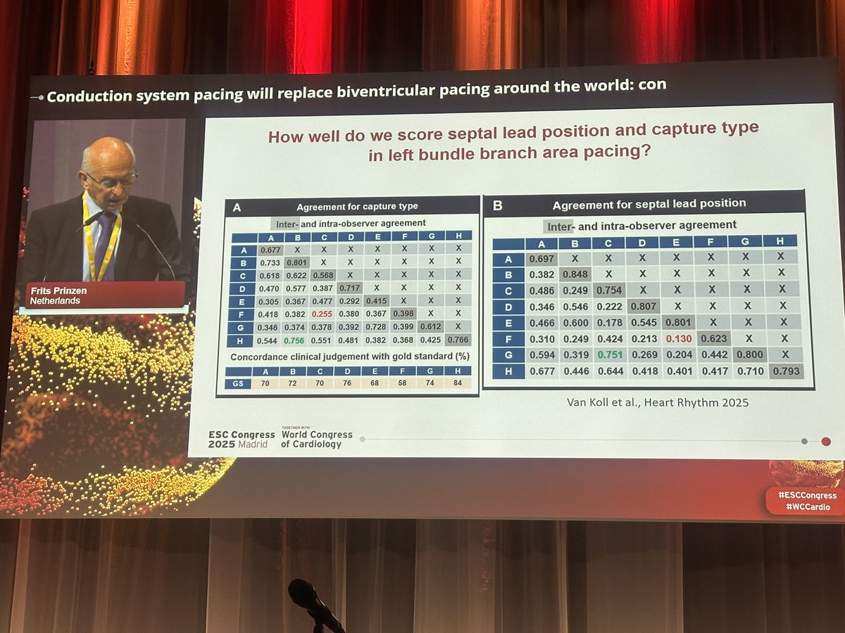 <a href="/LinaMarcantoni/">lina marcantoni</a> <a href="/Dominik_Linz/">Dominik Linz</a> <a href="/PriyaPBK/">Priya Bhardwaj</a> <a href="/veramasloo/">Vera Maslova</a> <a href="/AugustoMeretta/">Augusto Meretta</a> <a href="/HaranBurri/">Haran Burri</a> <a href="/OCanoPerez/">Óscar Cano</a> <a href="/JacopoImberti/">Jacopo Imberti</a> Fritz Prinzen on CON side of CSP will replace BiVp

1️⃣ Larger randomized trials needed
2️⃣ LBBAP is not effective in IVCD
3️⃣ Definition of LBBAP capture are too complex 

#ESCCongress