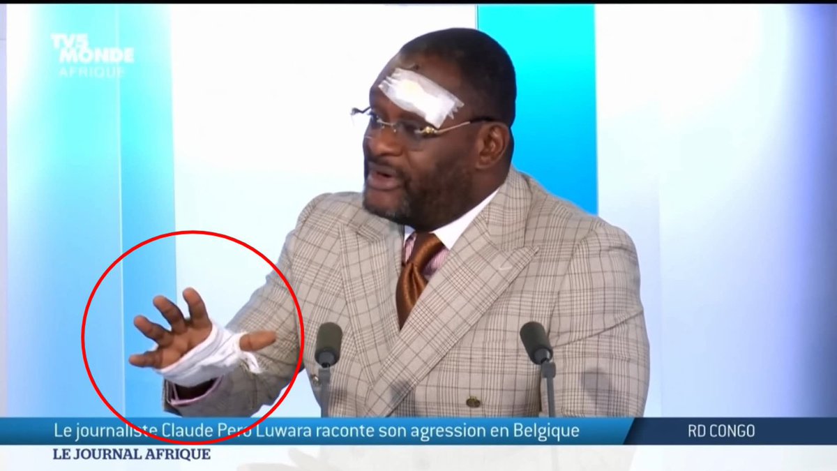 Durant l'interview, c'est cette main qui bouge du début à la fin. 
Ça sent le coup monté! 😂😂😂😂👌