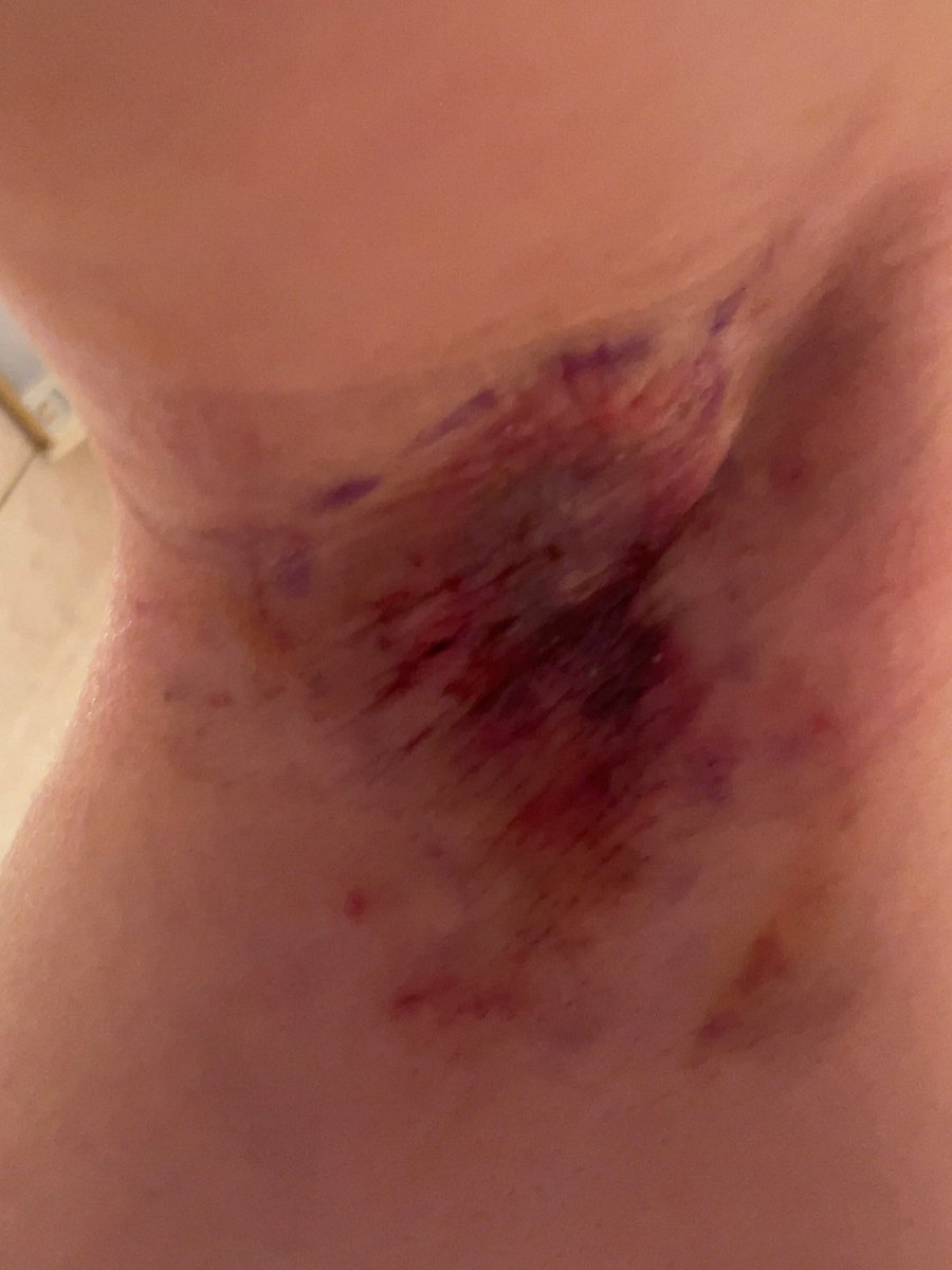 普通のOL(剪除法レポ) tweet media