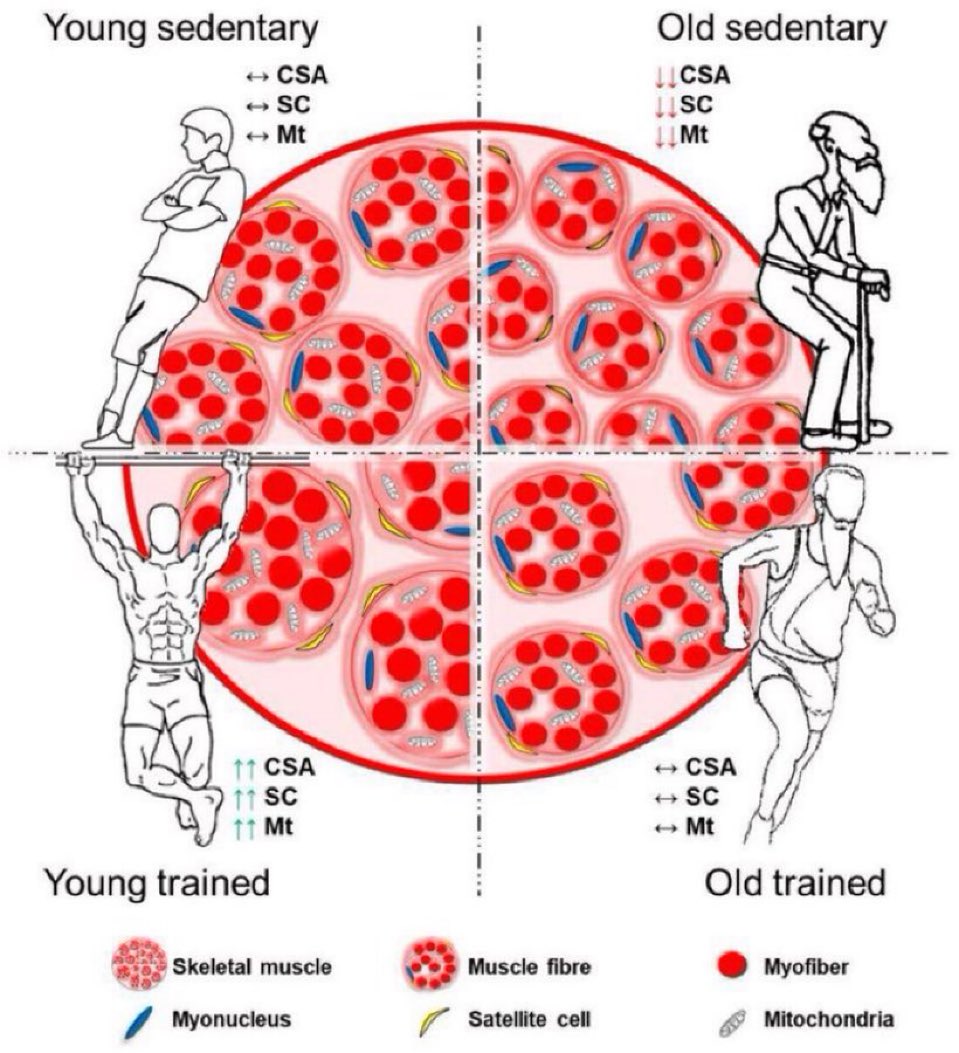 Exercise induced adaptation on skeletal muscle

Ageing👉🏾muscle fiber atrophy, ⤵️satellite cells (SC) &amp; mitochondrial (Mt) number

Exercise👉🏾reverse negative effects of ageing, muscle fiber hypertrophy, ⤴️ cross section area (CSA), ⤴️SC &amp; Mt number

#muscle
mdpi.com/2073-4409/7/12…