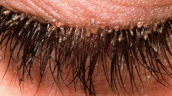 Fiona Seclit Officiel•le 🇪🇺☭⚧️🐵🏳️‍🌈💉 tweet media