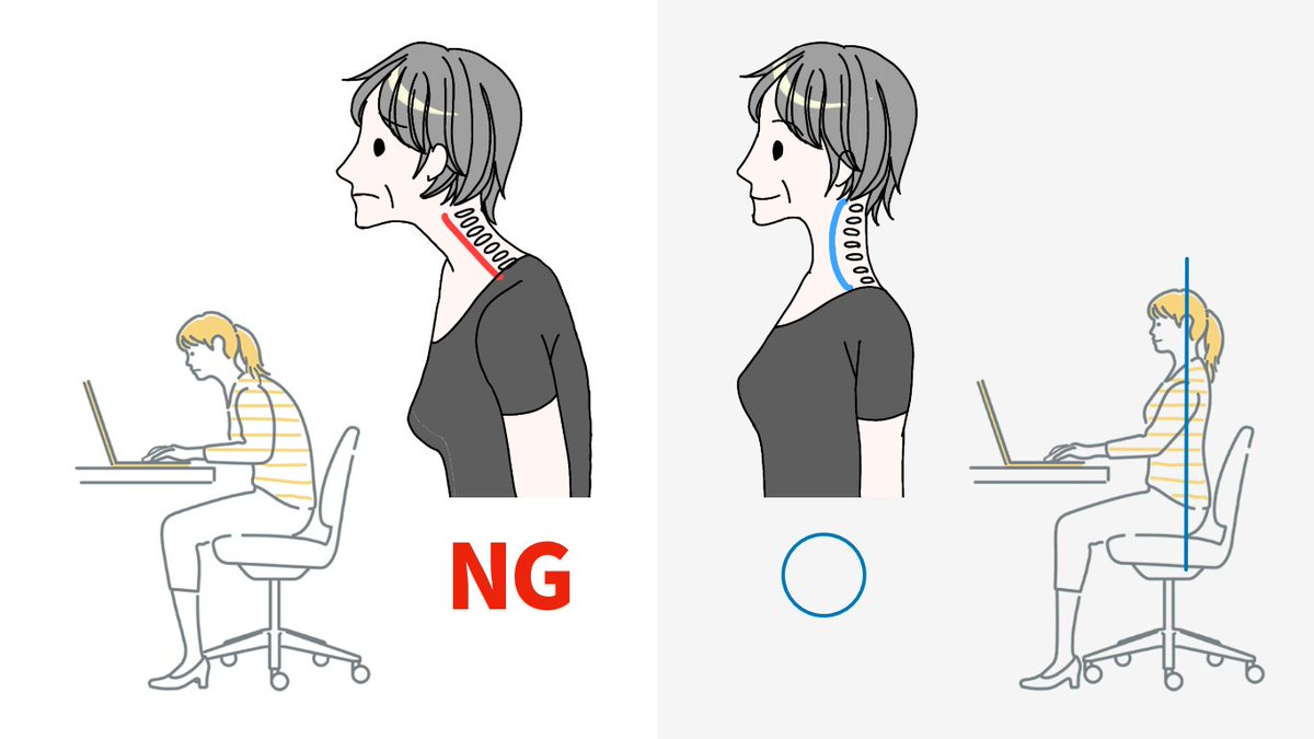 トレーナー指導入門講座

胸や肩の不具合は、頭の位置や体幹の安定にあることがあります。

可能性のあるヘッドフォワードポスチャー　→ 原因と改善、実際の指導事例とともに解説。デスクワークやスマホ作業が多いお客さんへの指導にも役立ちます。
👉 gym-personal.com/7064