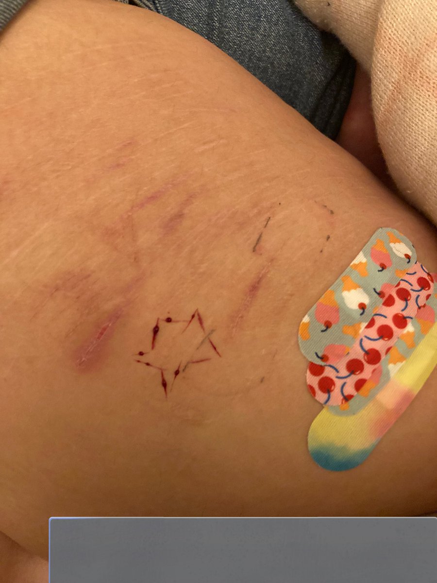 I had a tiny sesh and made a star :3 (ik its so ass but it was my first time )