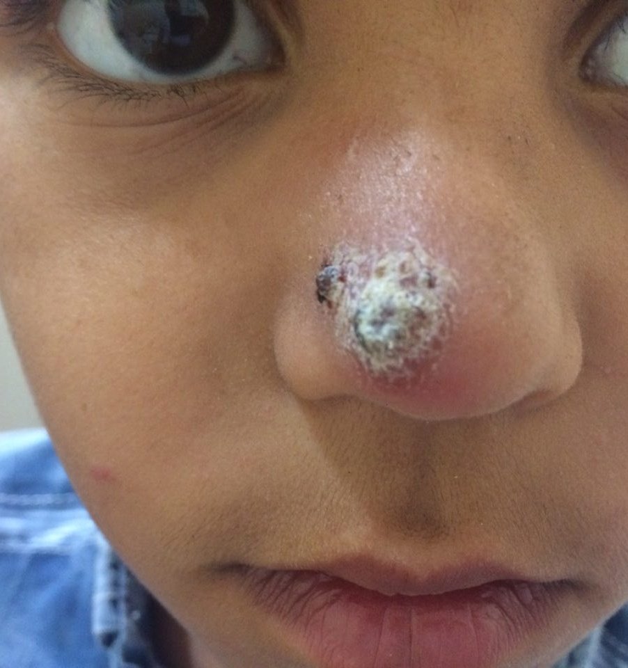 What is the diagnosis?
What city name is related