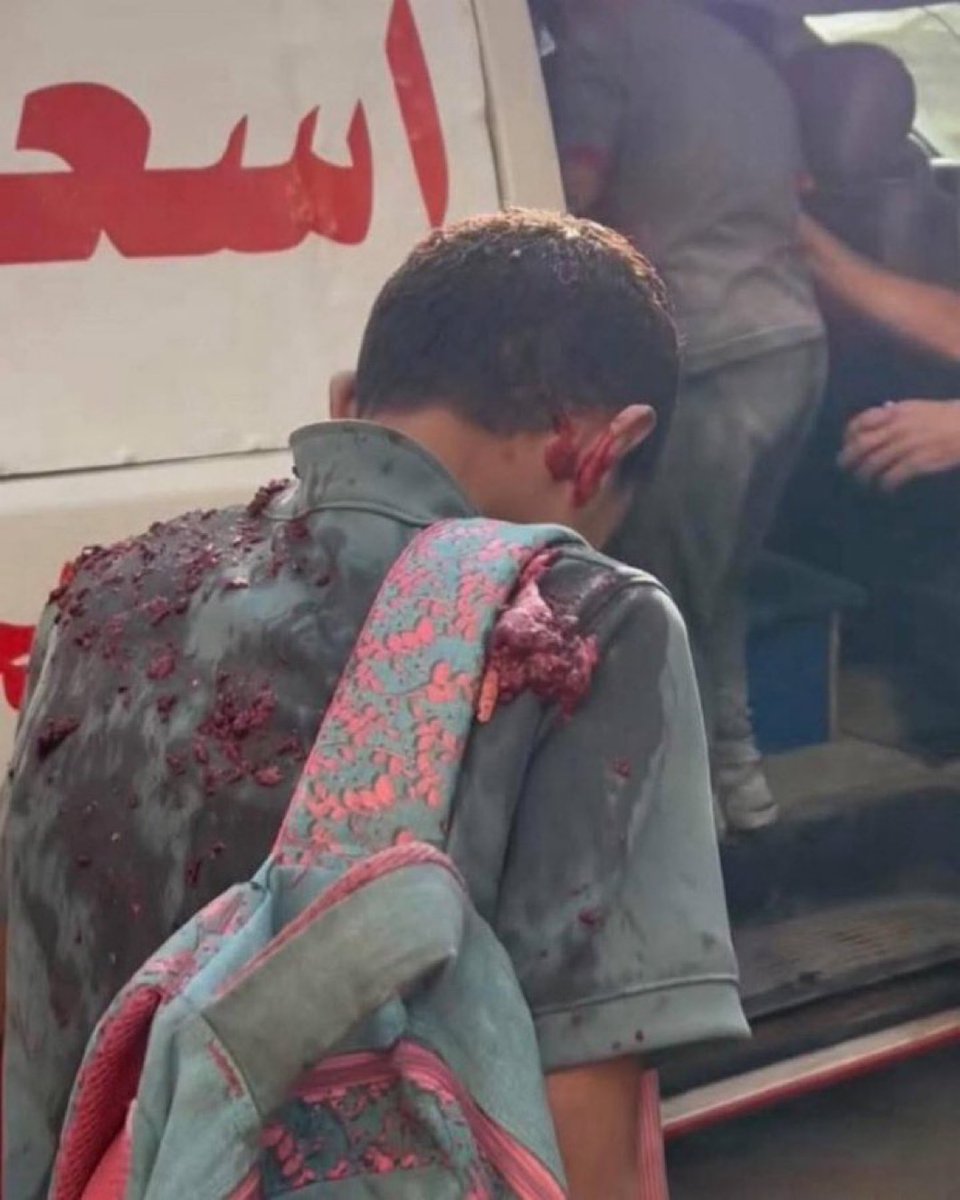 Those are the remains of his family on his back. 

THE MEDIA WILL NEVER SHOW YOU THIS