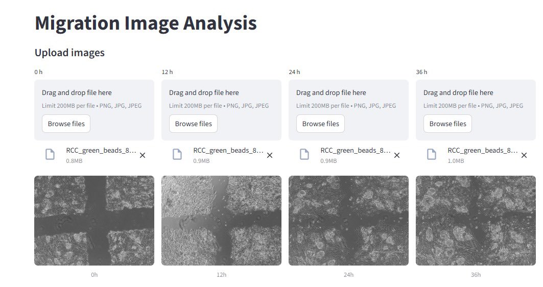 LauraBukavinaMD's tweet image. Migration analysis made easy by our lab genius @MSindhani  #sciencecomm #cancerresearch Check it out here &amp;gt;&amp;gt;&amp;gt;&amp;gt; …-rjju74g2v6h6u5tsdk2swm.streamlit.app