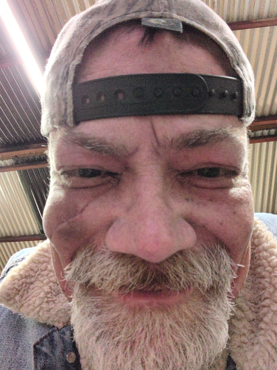 PatMrClean's tweet image. Still alive. now with added scars.