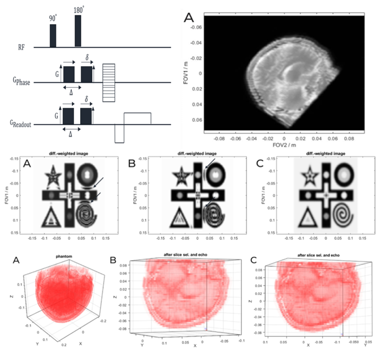 medntdj's tweet image. Efficient quantum of mechanical simulation of diffusion-weighted MRI
sciencedirect.com/science/articl…
#Bloch-torrey equations #Magnetic resonance imaging #Polyadic de-compaction #Diffusion-weighted images #Quantum mechanics #technology #research #innovation