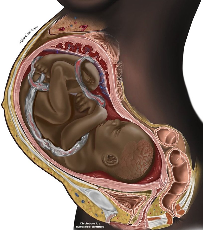 Republican Party of Calumet County (@calumetgop) on Twitter photo Democrats scream Black Lives Matter, but they refuse to defend Unborn Black Babies.
Join the Republican Party, where ALL Unborn Babies matter.
<a href="/Moms4Liberty/">Moms for Liberty</a> <a href="/momsforamerica/">Moms for America</a> <a href="/WIFamilyAction/">✰✰Wisconsin Family Action✰✰</a> <a href="/WIPatriots/">Wisconsin Patriots</a> <a href="/wisconsin_now/">Wisconsin Right Now</a> <a href="/WhiteHouse/">The White House</a> Democrats scream Black Lives Matter, but they refuse to defend Unborn Black Babies.
Join the Republican Party, where ALL Unborn Babies matter.
<a href="/Moms4Liberty/">Moms for Liberty</a> <a href="/momsforamerica/">Moms for America</a> <a href="/WIFamilyAction/">✰✰Wisconsin Family Action✰✰</a> <a href="/WIPatriots/">Wisconsin Patriots</a> <a href="/wisconsin_now/">Wisconsin Right Now</a> <a href="/WhiteHouse/">The White House</a>