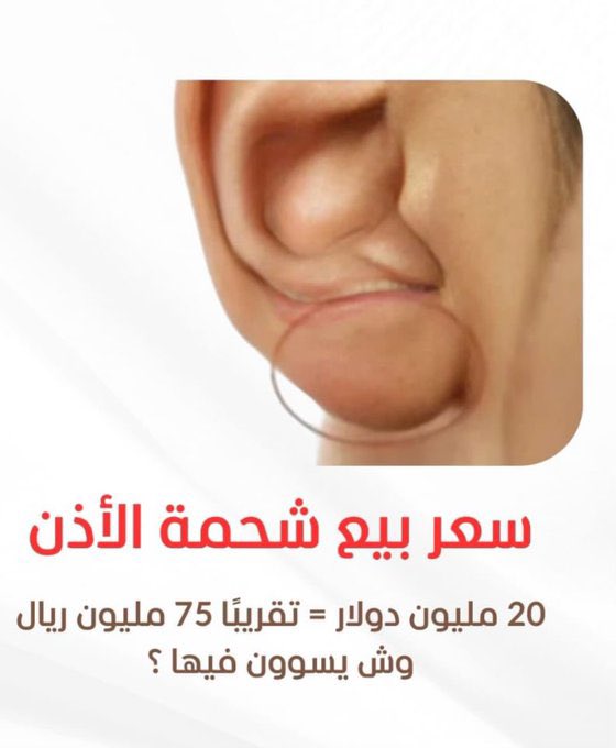 اذا صج هالسالفه ابيع اذني كلها ونخلص هالبيت اللي شقونا العمال 🙇🏻💫