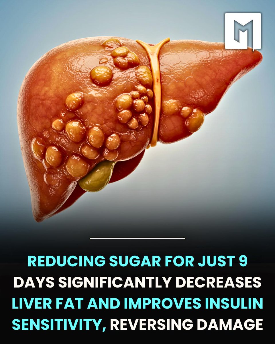 A study from Touro University and UC San Francisco, published in Gastroenterology, found that a nine-day diet low in added fructose—the kind of sugar in sodas, fruit juices, and many processed foods—reduced liver fat by over 20% in children and teens.