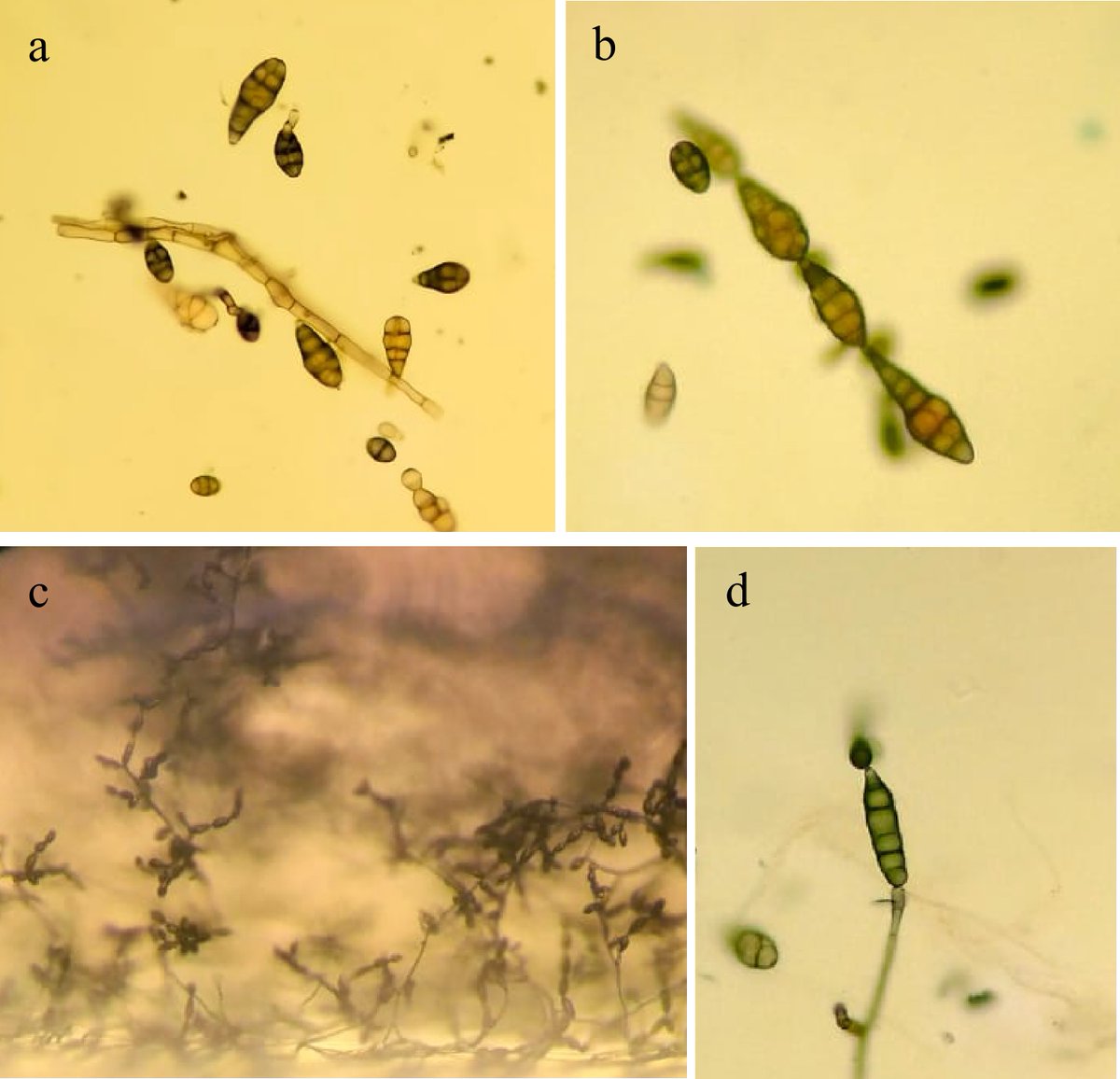 MaximumAcademic's tweet image. #SIF
A review focuses on Alternaria alternata: the most common pathogen on date palm.
@EcologicalAR @BasraUniversity  #PlantPathology  #FungalPathogen #Symptoms #DiseaseManagement #DatePalm
Details: maxapress.com/article/doi/10…