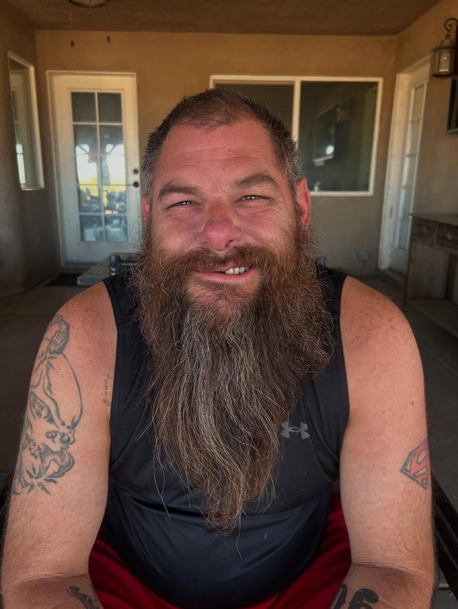 🏥🚨 Stuart Smith has been released from the hospital and is now recovering at home.

He was rushed to the ER unconscious with a severe head injury — suffering jaw trauma, a fractured maxilla, a cut lip, and multiple lost teeth.

(via Syko Stu IG)