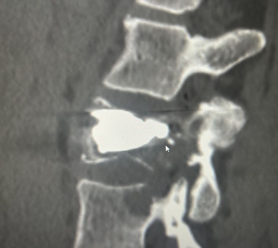 Interventional Oncology Institute tweet media