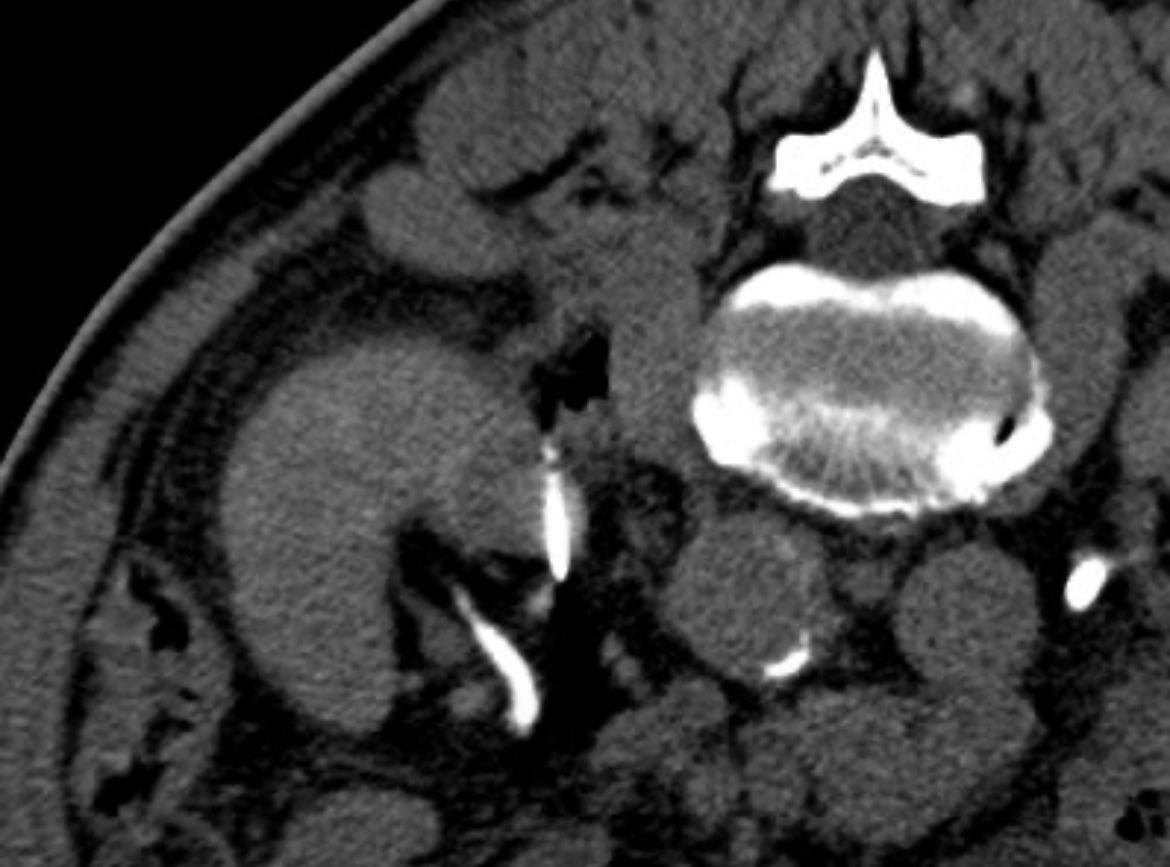 Interventional Oncology Institute tweet media