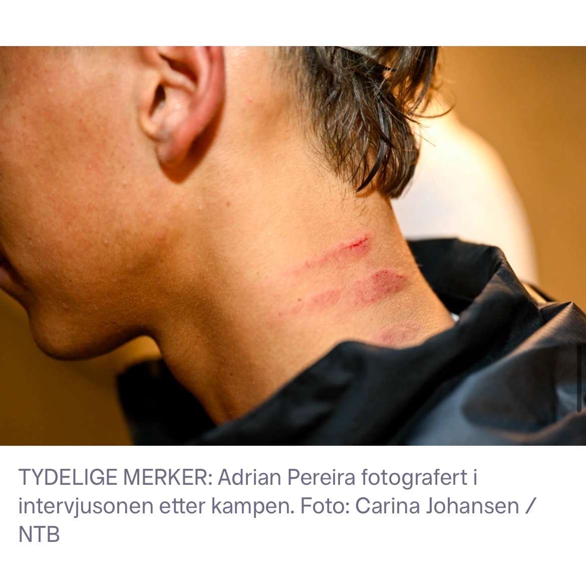 TRIPIC BURDE BLI UTESTENGT!!! Hva faen er det her for no