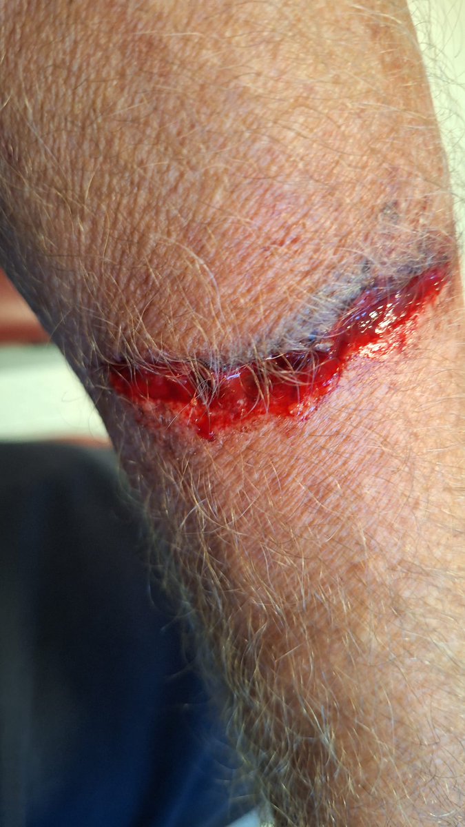 I swear hubby had my blood pressure going this morning, he went out to help a friend with painting, standing at the bottom of a ladder and the sign above blew off in the wind he is so lucky, he has ended up with stitches so lucky it miss his artery