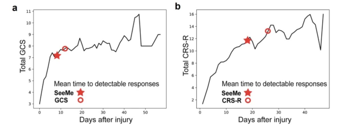 SeeMe can spot hidden signs of consciousness in comatose patients before they are noticed by doctors nature.com/articles/s4385…