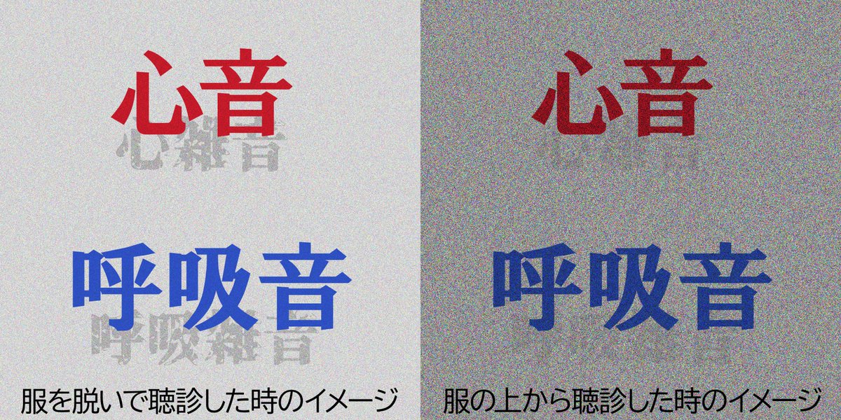 「聴診」って「心音や呼吸音を聞く」ものだというイメージがあるかもしれないけど、実際には「正常な心音や呼吸音の奥にある心雑音や呼吸雑音などがないか探す」身体検査なのね。探す対象が心音や呼吸音ほどはっきりしていない「微妙な雑音」だから、服を脱いでもらって聞いてもぼーっとしてたら聞き逃