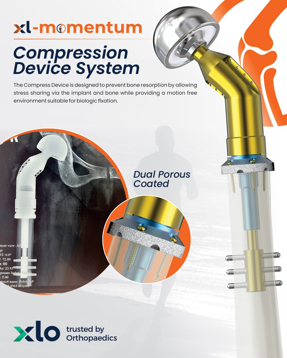 xlortho's tweet photo. Redefining Stability. Empowering Mobility.
#Orthopaedics #BoneHealth #InnovationInCare #CompressionDevice #XLMomentum #TrustedByOrthopaedics #Biomechanics #JointCare #MedicalInnovation #XLO https://t.co/1Qn5diZzdZ