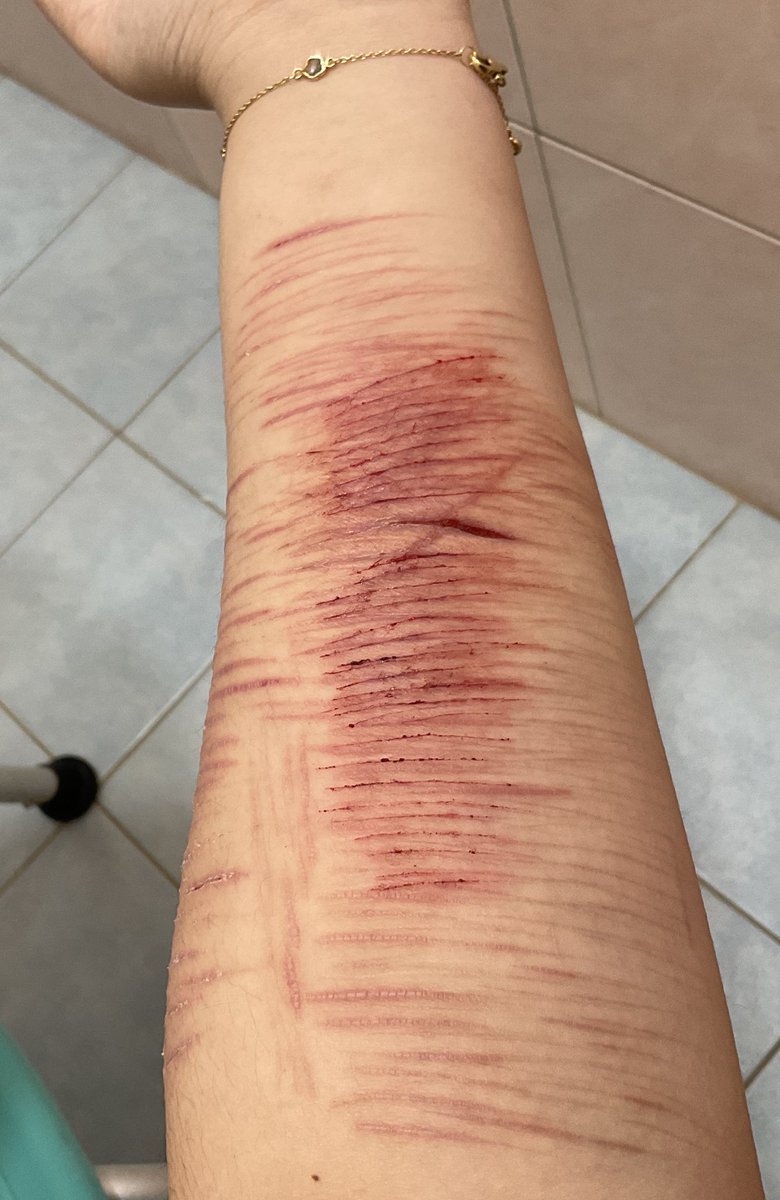 I don't want to cut too deep or I'll get scolded again
#shtwt #scars