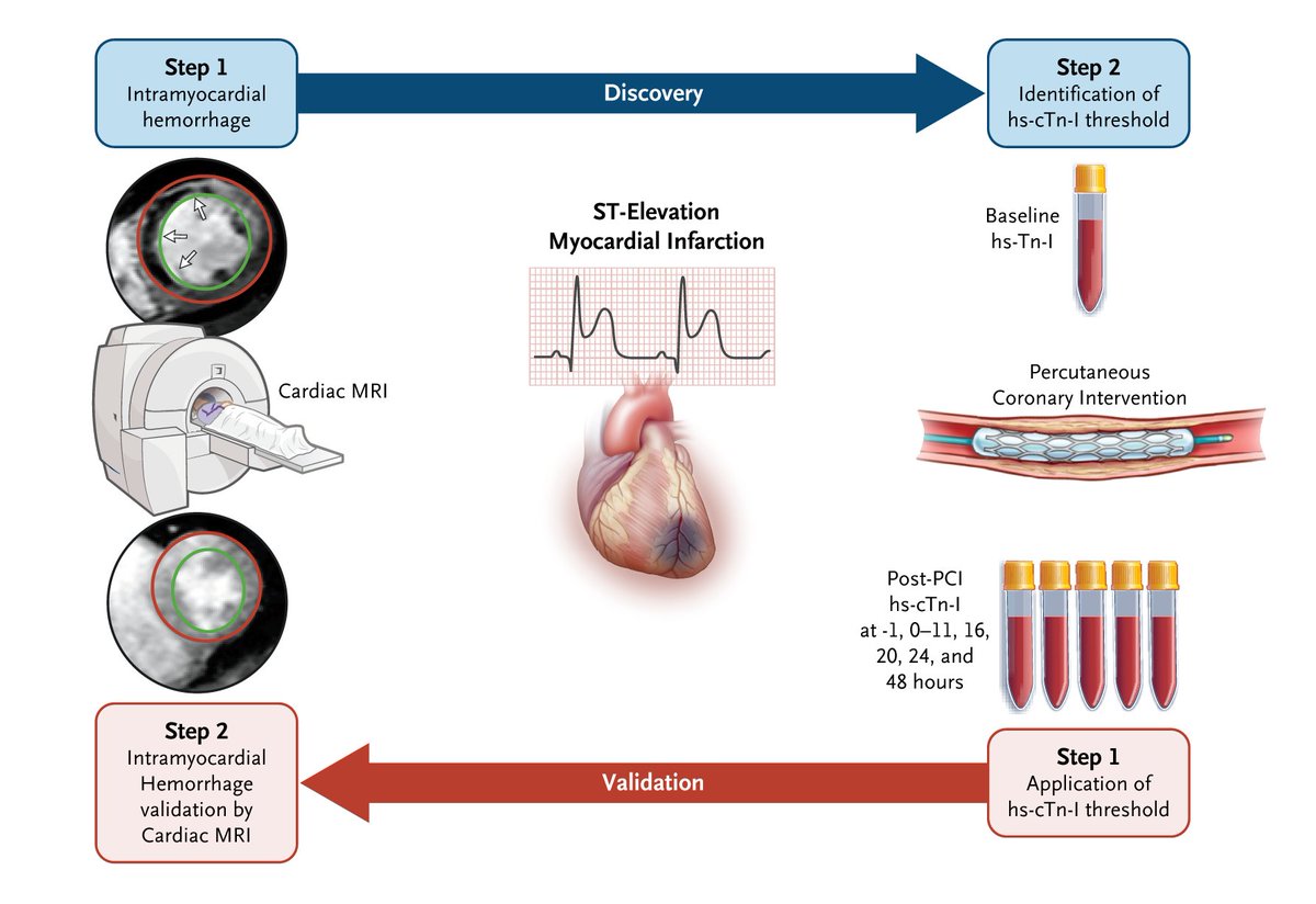 Intramyocardial hemorrhage following primary PCI is a major predictor of adverse cardiovascular outcomes but is difficult to diagnose in real time. Vora et al. describe the use of post-PCI troponin kinetics to make the diagnosis. eviden.cc/47FEcTI