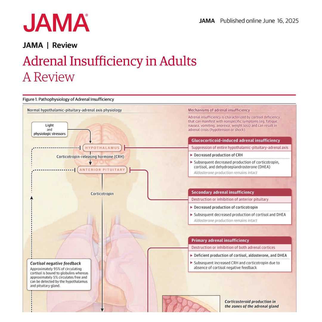Adrenal insufficiency is a syndrome of cortisol deficiency. 

This Review summarizes the pathophysiology of adrenal insufficiency and approaches to diagnosis, treatment, and prevention of adrenal crisis. 

ja.ma/4oXJS1G