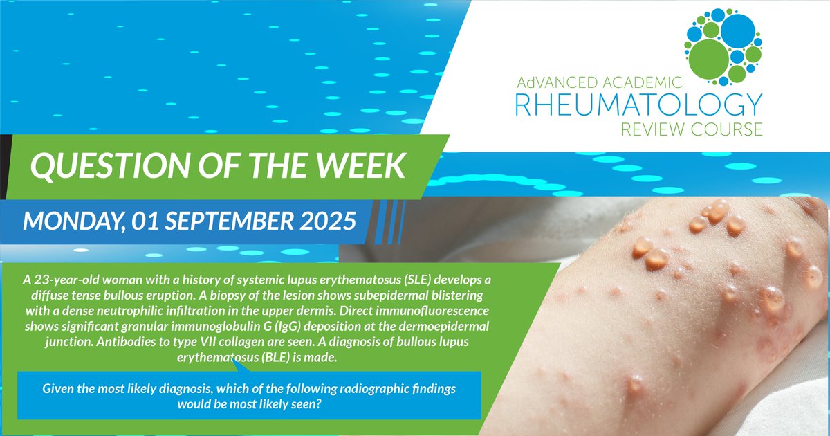 adarrc's tweet image. Try this week’s Monday Kickoff Quiz to explore clinical cases and test your understanding.

Take the Quiz: bit.ly/3JZfpQF

#RheumQuiz #MedTwitter #Rheumatology #ClinicalPearls
