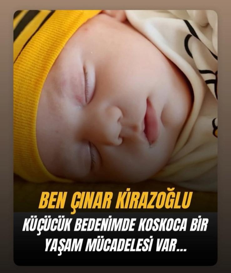 Duy duyur paylaştır Sizlerle güçlüyüz birlikte Zolgensma ilacına kavuşturalım 

#LookmanFenere Adidas  Hande Ebrar Vagas Eda Erdem 
#FileninSultanları Özgür Özel 
#SYDVdeGREVEdevam Onana Martinez Emiliano #WLFI
#HakanCimboma