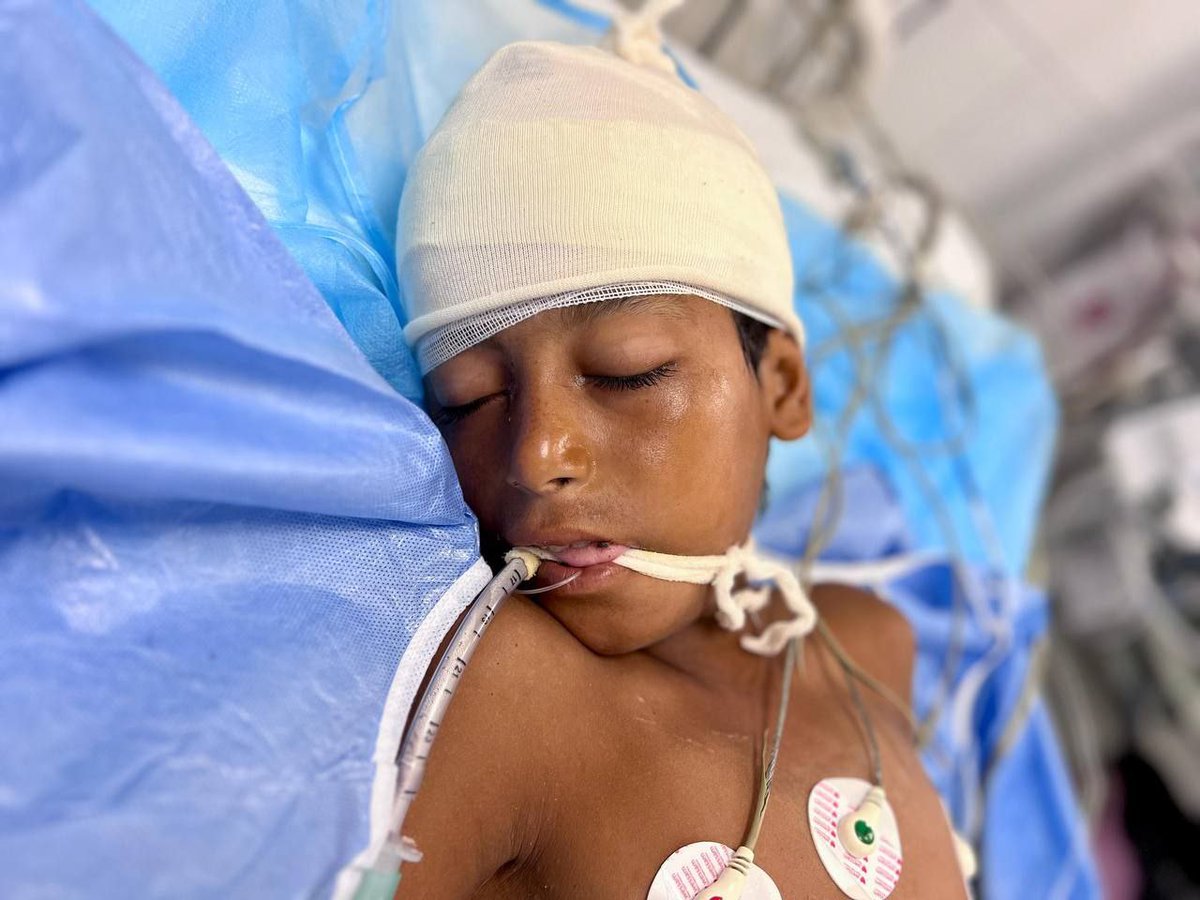 . الجراح يصرخ: "أعطوني دم بسرعة!"
الطفل على السرير ينزف بصمت، عيونه نصف مفتوحة كأنه يودع الحياة.
الممرضة تهمس بحزن لا يوجد وحدات دم متبقية ساد الصمت.توقفت الأجهزةوخسرنا روحًا أخرى فقط لأن الدم نفد.
هكذا يموت أطفال غزة.. ليس فقط بالقصف، بل أحيانًا بنقص كيس دم.
منقول عن صفحة طبيب