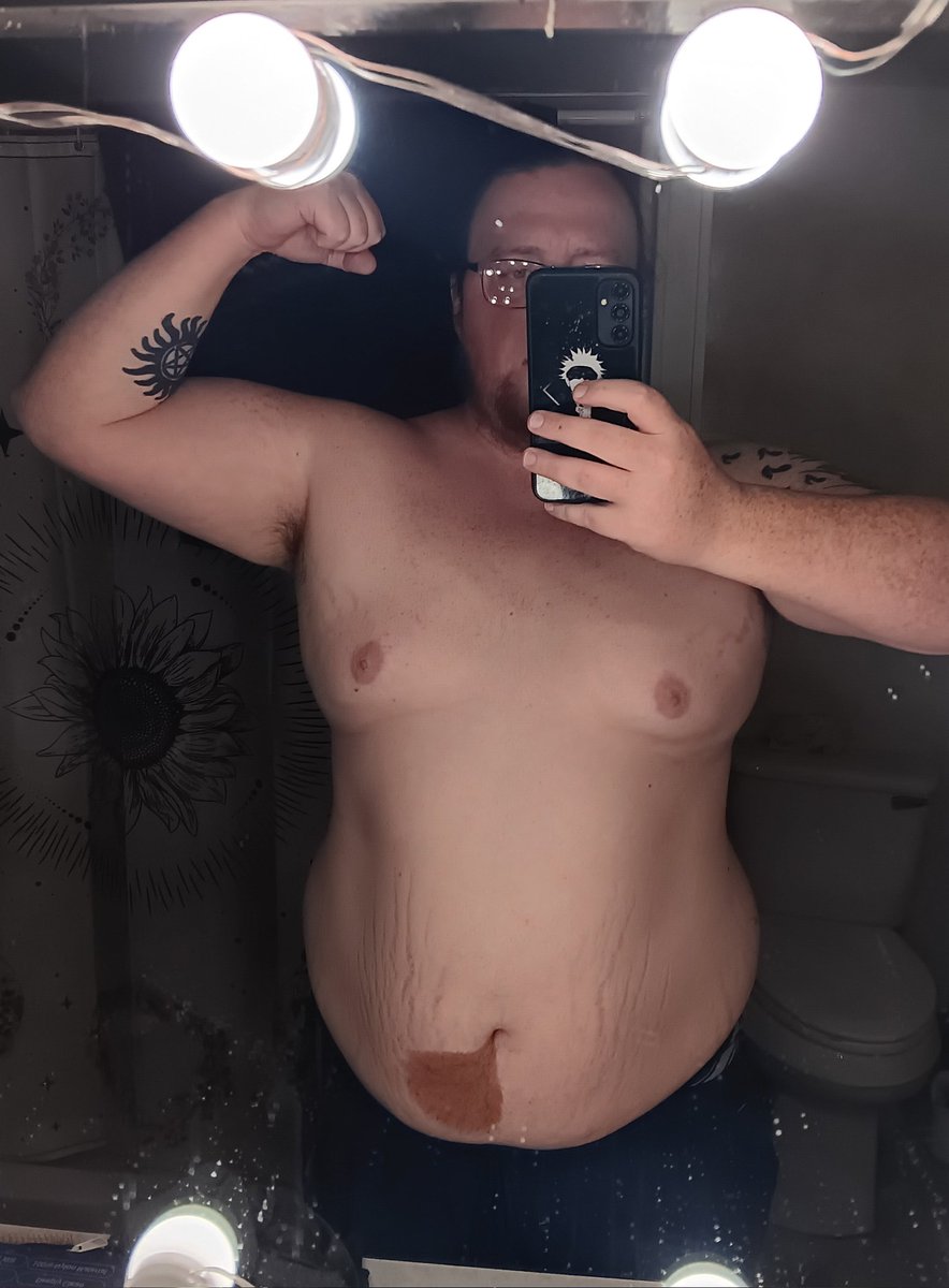 FoxWRLD's tweet photo. 7 month difference 
Feb 1st 315 pounds ish (330 before I got sick)

Then now today at 209.8 pounds. We STICKING TO IT #gymmotivation a calorie deficit and going to the gym WORKS #weightloss https://t.co/QhOYvVaG2K