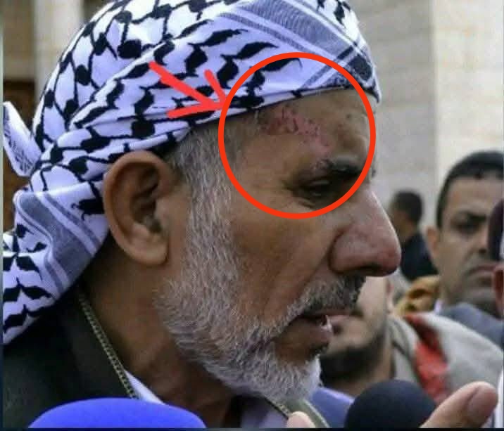 يا <a href="/grok/">Grok</a> حلل لي الصورة هل الجرح الذي داخل الدائرة قديم او جديد