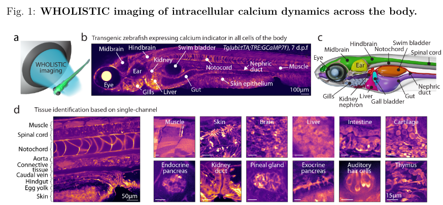 dz_gong's tweet image. Calcium imaging throughout entire fish bodies (including liver, pancreas, and kidneys😋)
biorxiv.org/content/10.110…