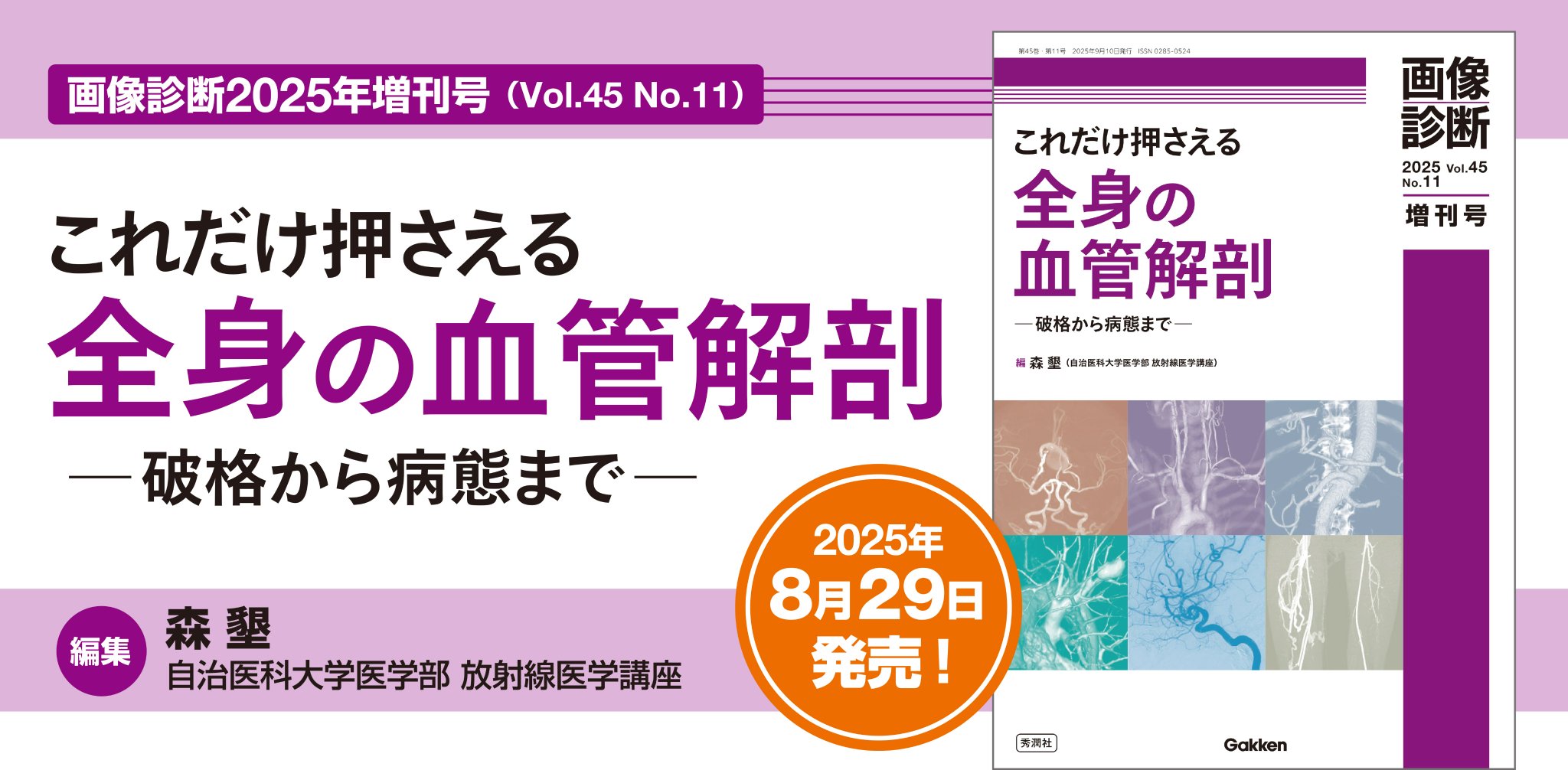 皮膚血管炎　第2版　裁断済み Amazon.co.jp: 皮膚血管炎 第2版 : 川名 誠司, 陳 科榮: 本