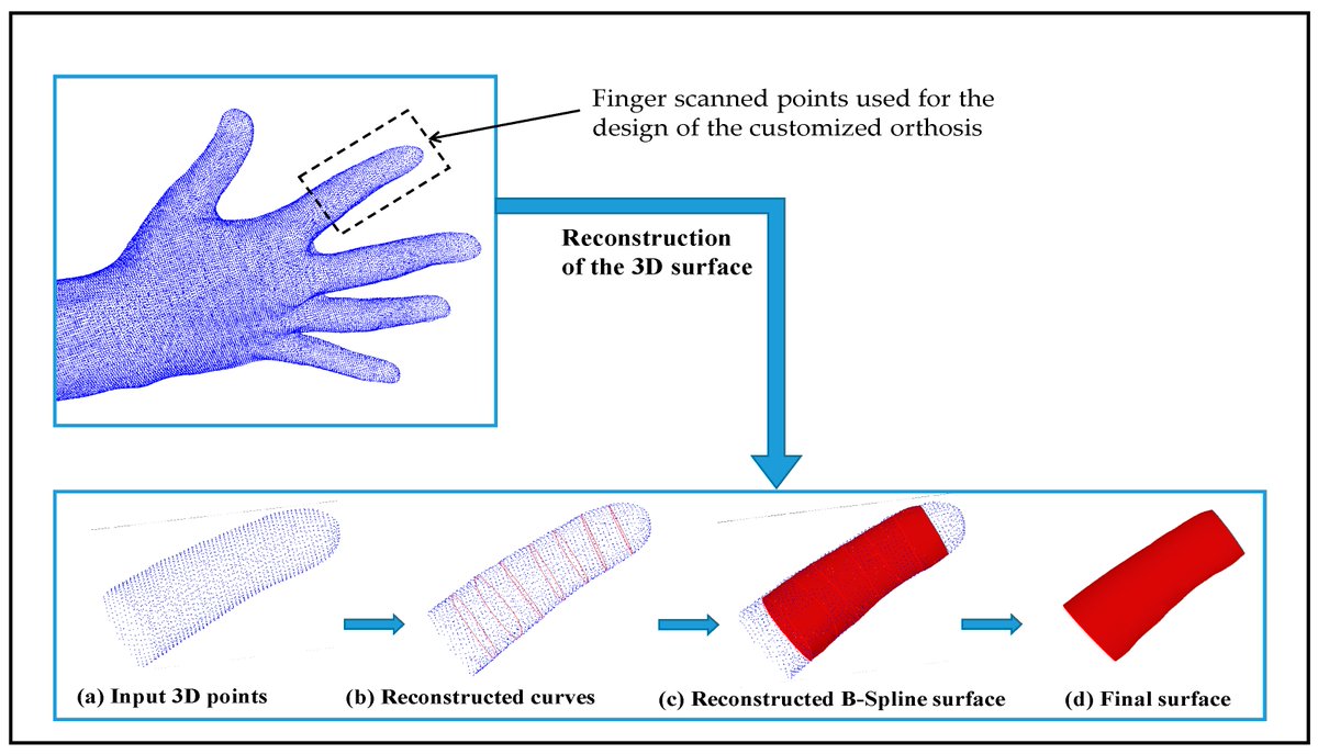 Prosthesis_MDPI's tweet image. Key advance in custom orthosis design! 🦾 B-Spline 3D scan surface recon—ultra-low MRMS error, outperforms existing methods.

Great for finger/foot orthoses, boosts fit &amp;amp; comfort! 📏

🔗doi.org/10.3390/prosth…

#3DReconstruction #CustomOrthosis #Medical3DPrinting #DigitalHealth