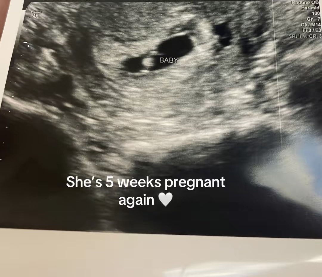 LKSurrogacy's tweet photo. Some women don’t just grow babies,

they grow families. 🧡🧡

We love you, K https://t.co/KZeAj9fFys