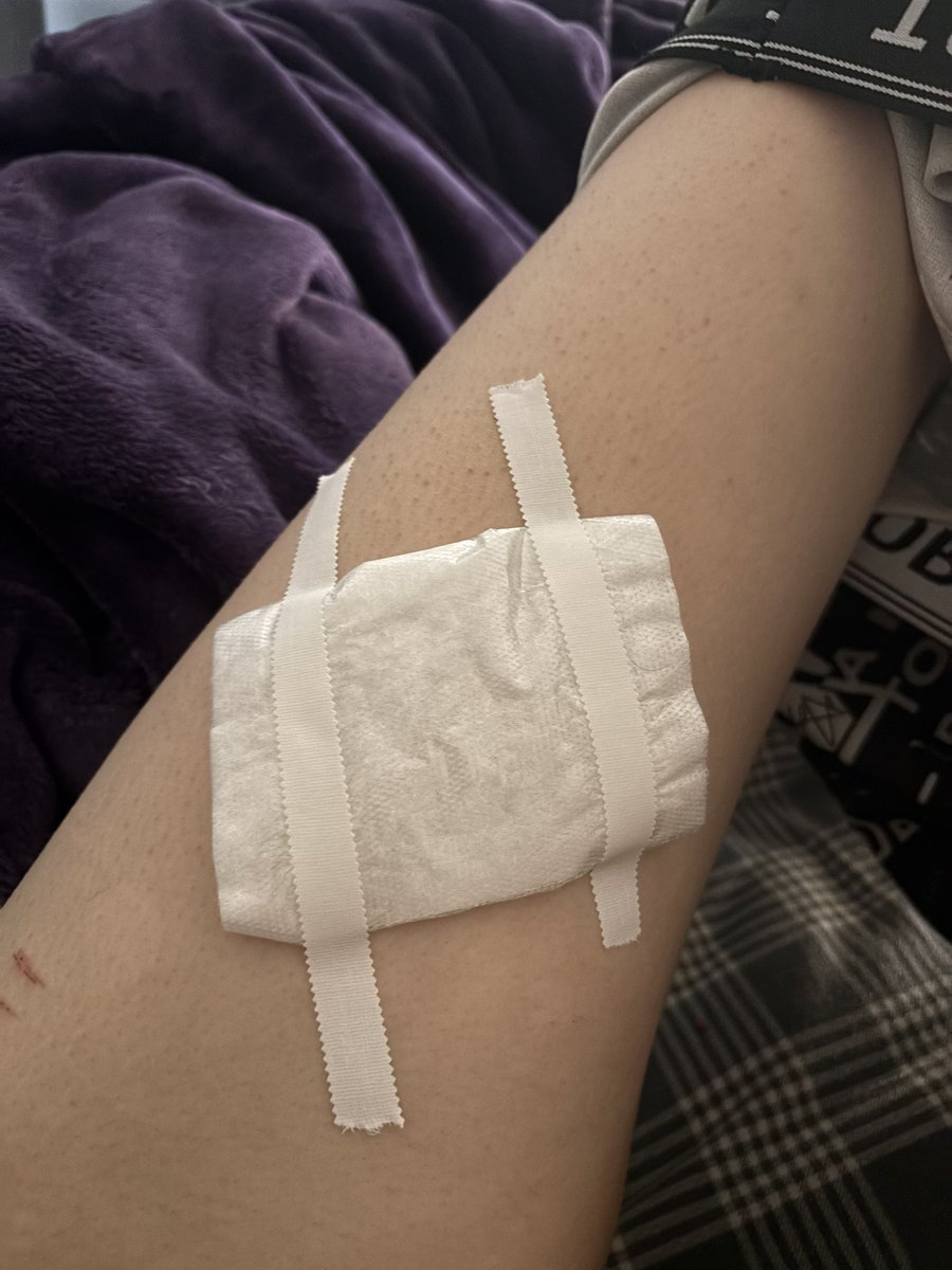 bluntinthebush's tweet photo. bandage changed.  found something that works better and won’t fall off 💜 #shtwt #slittwt #suicidetwt #helpmetwt #someonenoticemetwt #ineedhelptwt #pleasedontignoremetwt #imwitheringawaytwt https://t.co/QyYG9aywcF