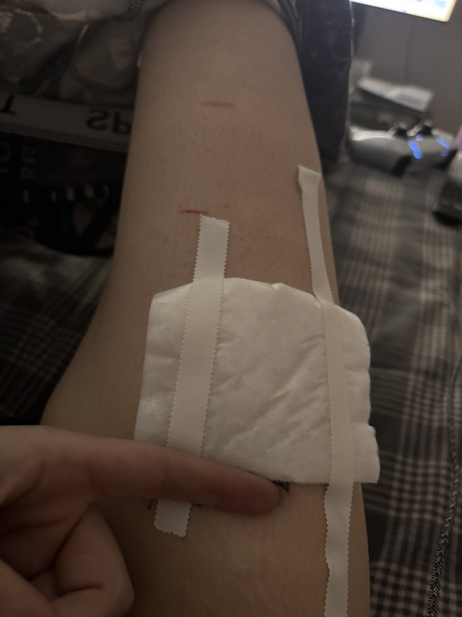 bluntinthebush's tweet photo. bandage changed.  found something that works better and won’t fall off 💜 #shtwt #slittwt #suicidetwt #helpmetwt #someonenoticemetwt #ineedhelptwt #pleasedontignoremetwt #imwitheringawaytwt https://t.co/QyYG9aywcF