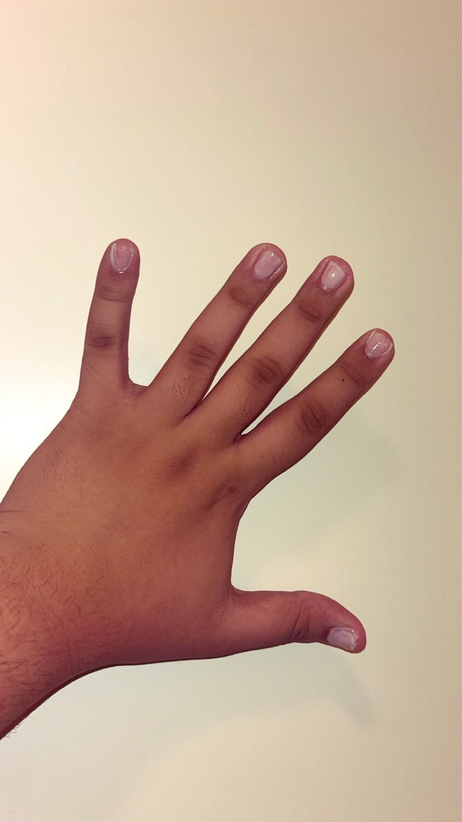 Yasse5m's tweet image. This is the second time I’ve applied nail polish. I don’t think the result is perfect, but what do you think?” 💅✨

#NailPolish #QueerStyle #LGBTQ #NailsOfPride #PrideVibes