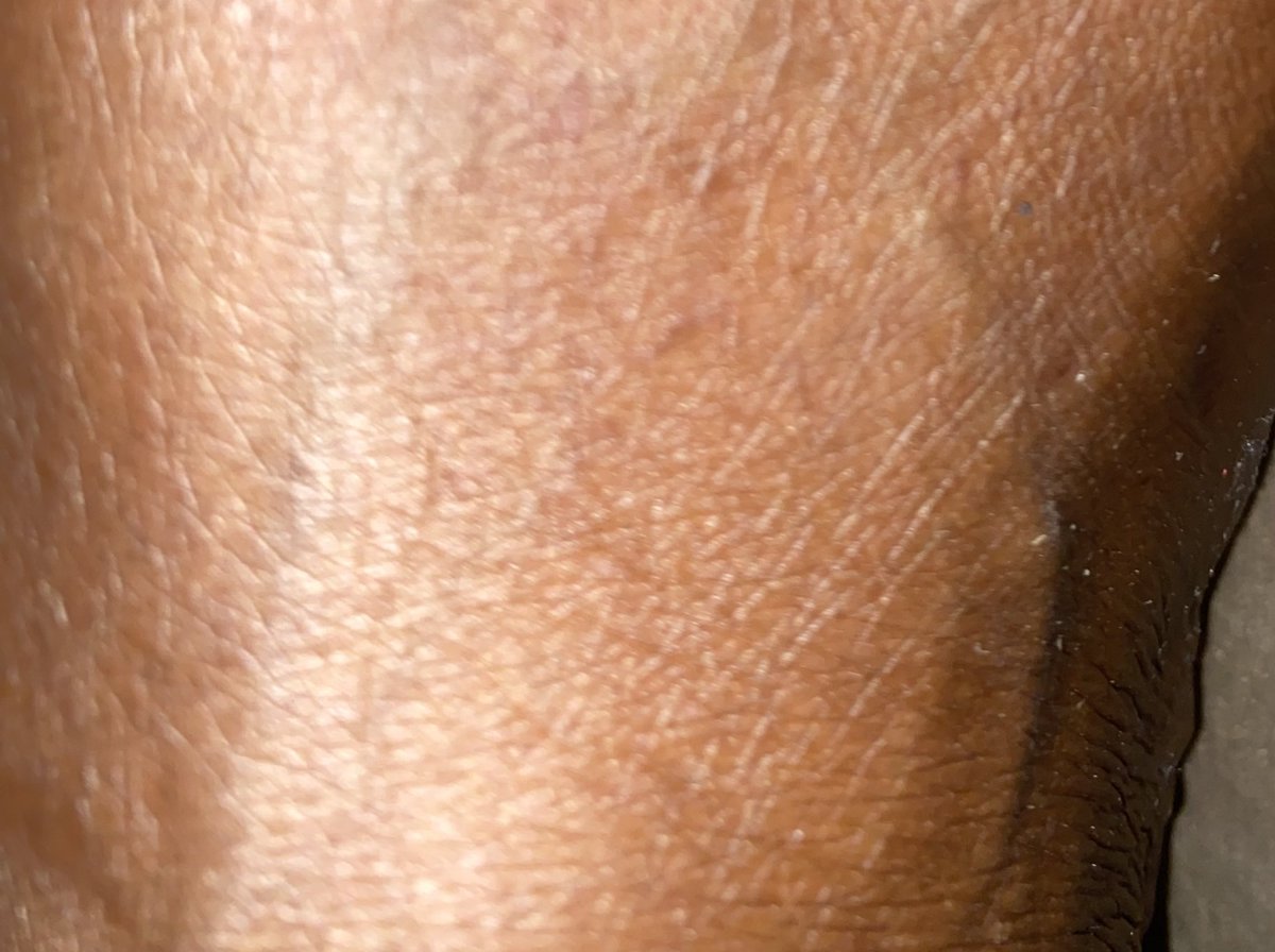 MathiasHannahC1's tweet photo. @ObaDeleke This part on your foot https://t.co/TK2DyJzaSI